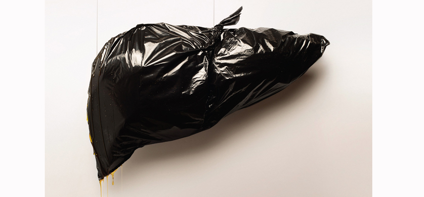 Grupo DDB desarrolló campaña para la Fundación de Trasplante Hepático
